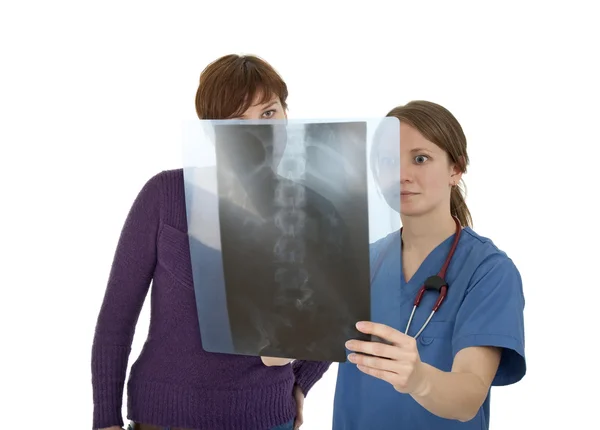 Sjuksköterska och patient ser på röntgen med orolig uttryck — Stockfoto