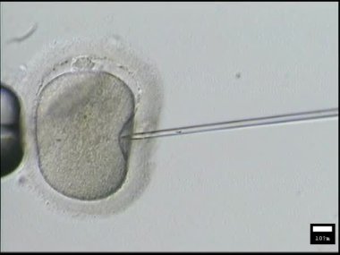 bir kadının içine yumurtayı sperm enjeksiyonu ile tüp bebek