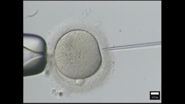 Введение спермы в яйцеклетку женщины для ЭКО — стоковое видео