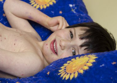 su çiçeği olan çocuk