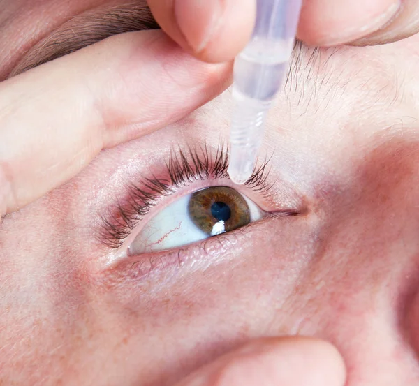 Hombre usando gotas para los ojos —  Fotos de Stock