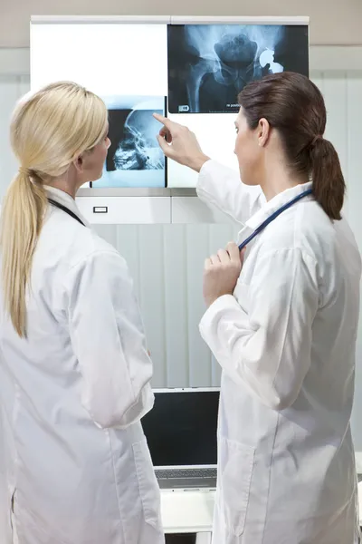 Kobieta kobiety szpitala lekarze patrząc na zdjęcia rentgenowskie idealna Laptop — Zdjęcie stockowe