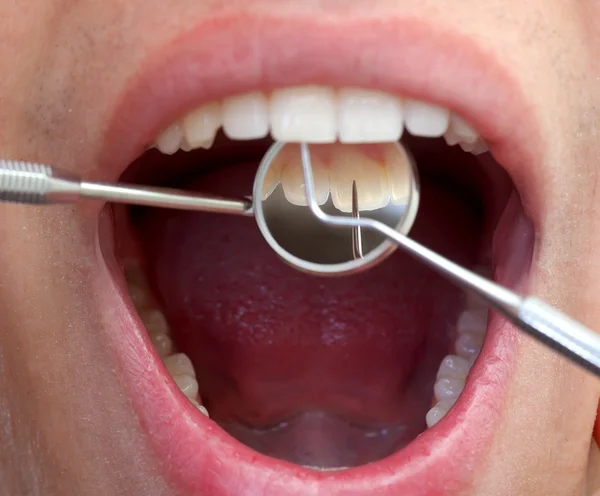 Examen dental extenso — Foto de Stock