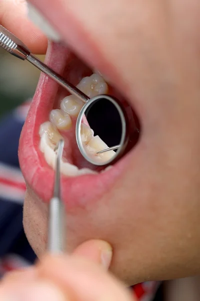 Ausgiebige Zahnuntersuchung — Stockfoto