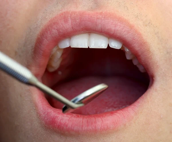 Examen dental — Foto de Stock