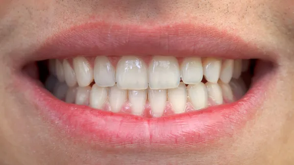 Boca y dientes — Foto de Stock