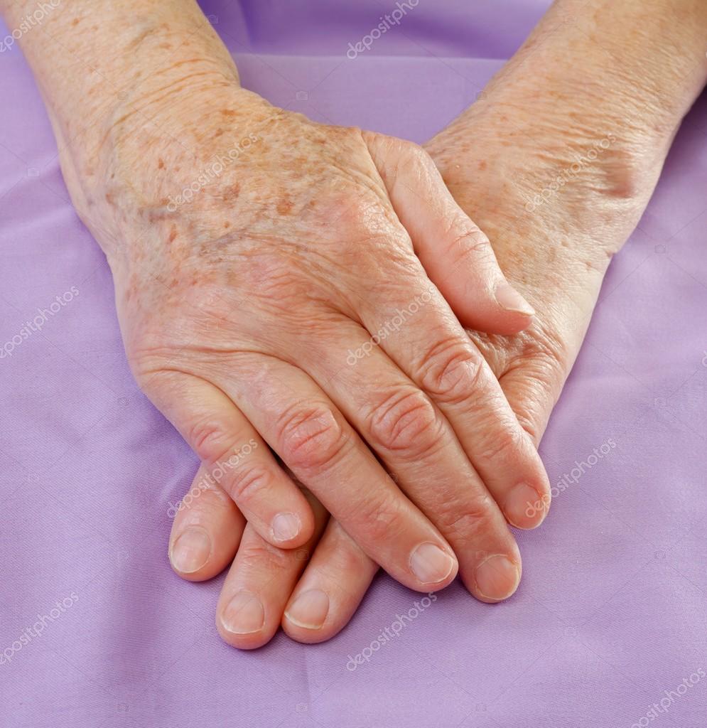 2 458 Age Spots Skin Stock Photos Age Spots Skin Images Depositphotos 2 458 Age Spots Skin Stock Photos Age Spots Skin Images Depositphotos