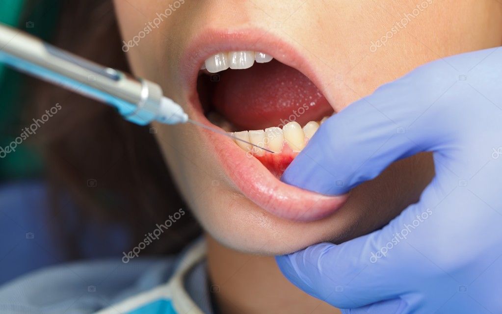 Dental anesthesia Stock Photo by ©ocskaymark 30514895