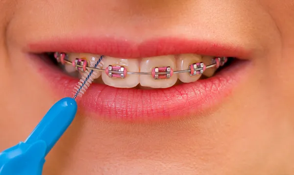 Interdental brushing — Stock Photo, Image