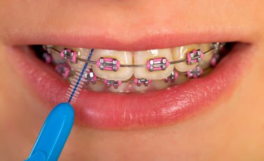 fırçalama interdental