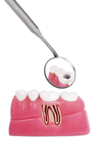 Анатомический зуб — стоковое фото