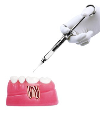 Dental treatment clipart