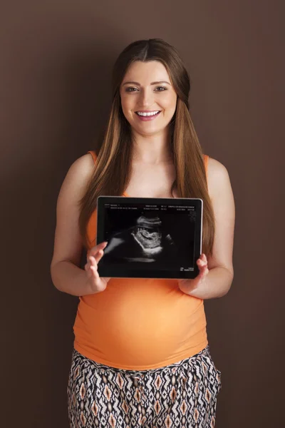 Femme enceinte montrant une échographie — Photo