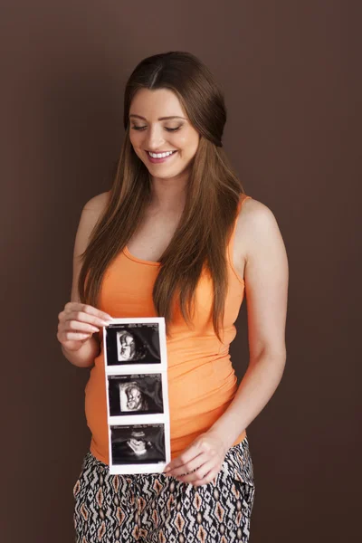 Pregnant woman with ultrasound scan — Stock Photo, Image