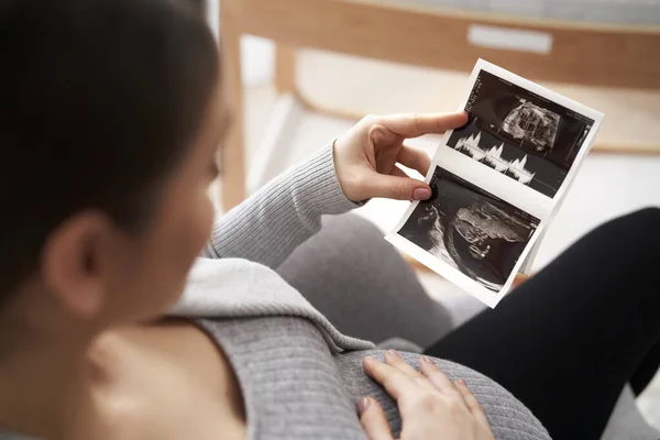 Vista Ángulo Alto Mujer Caucásica Embarazo Avanzado Exploración Por Ultrasonido —  Fotos de Stock