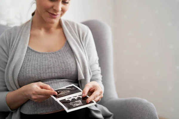 Белая Женщина Время Беременности Просматривает Ультразвуковое Сканирование — стоковое фото