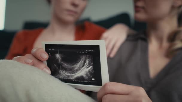 Рука Тримає Ультразвукове Сканування Дві Жінки Задньому Плані Знімок Гелієвою — стокове відео