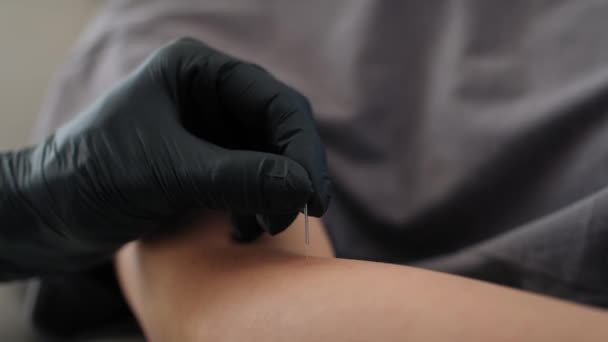 Close Acupuncture Specialist Inserting Needle Patient Hands Due Treatment Shot — Wideo stockowe