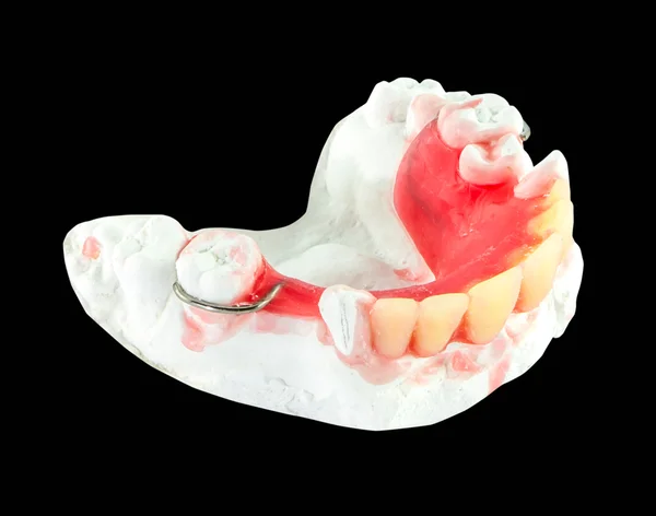 A viasz modell fogsor elkülönítése — Stock Fotó