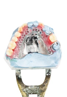 Balmumu kısmi takma diş, diş modelleri gösteriliyor 