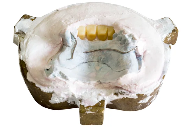 歯科医は専門的誰か口と teet の石膏型を作る — ストック写真