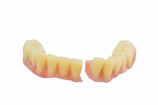 Broken denture — Stock Photo, Image