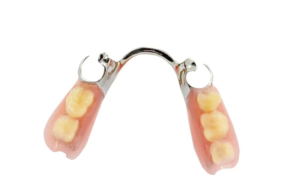 Prótesis dentales parciales sobre fondo blanco —  Fotos de Stock