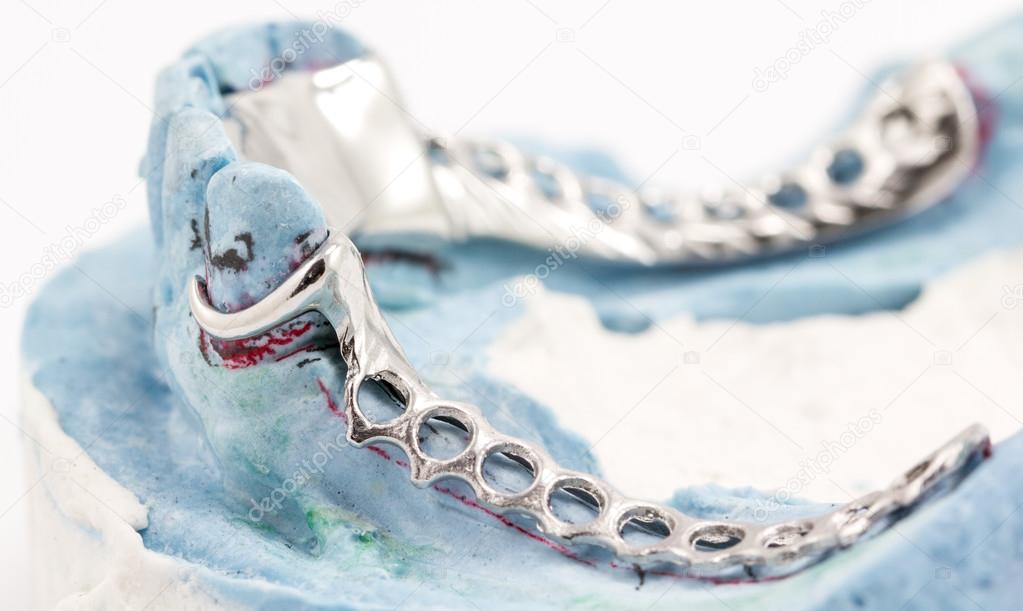 Dental wire bending