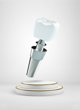 Bir podyumun arka planından izole edilmiş diş implantı