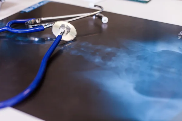 X-ray and stethoscope — Stock Photo, Image