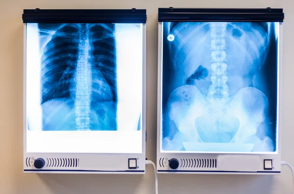 X-ray pictures — Stock Photo, Image