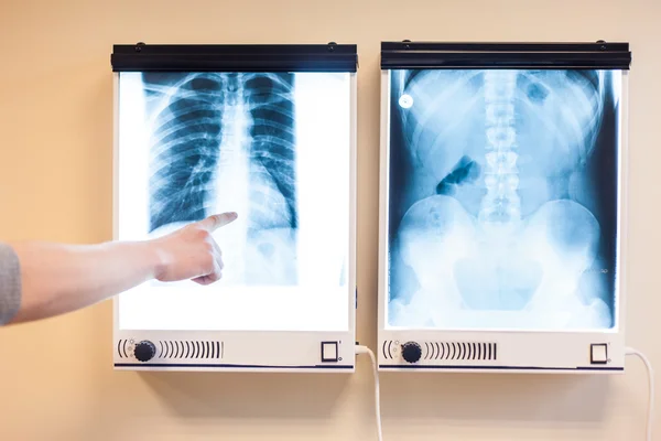 Hand pointing to X-ray pictures — Stock Photo, Image