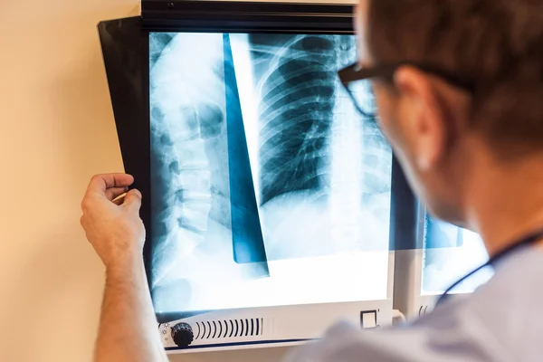 Médico examinando em imagens de raios-x — Fotografia de Stock