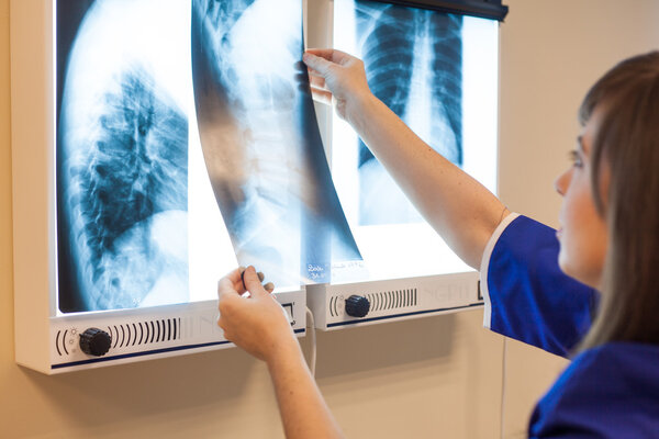 Doctor examining x-ray images