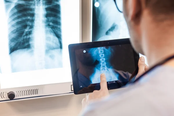 Доктор с планшетом изучает рентгеновские снимки Лицензионные Стоковые Фото
