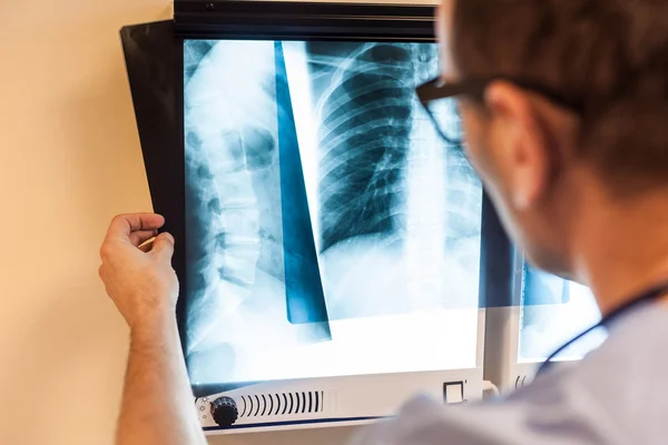Доктор осматривает рентгеновские снимки Лицензионные Стоковые Изображения