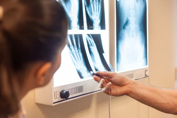 Médico examinando imagens de raios-x — Fotografia de Stock