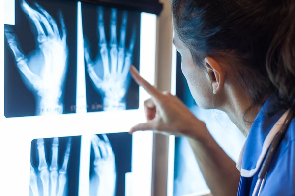 Doctor examining x-ray images — Stock Photo, Image