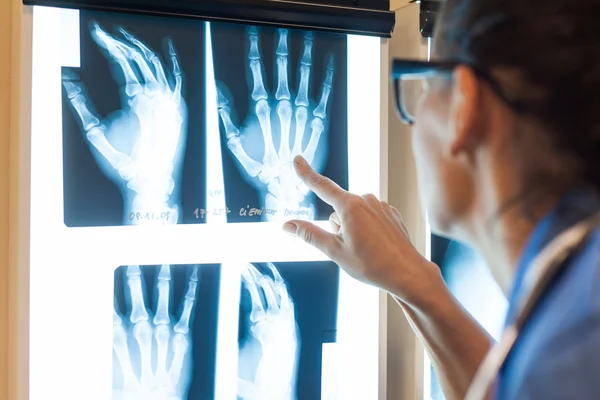 Médico examinando imagens de raios-x — Fotografia de Stock