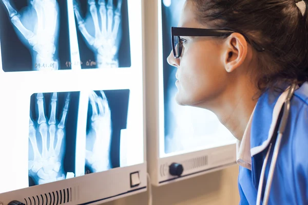 Lékař zkoumá x-ray snímky — Stock fotografie