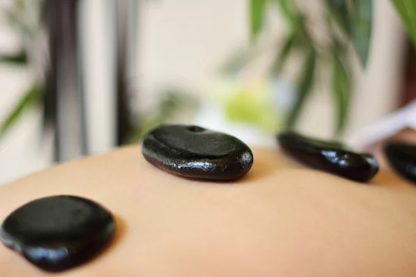 Hot Stone Massage - Spa — Stock Photo, Image