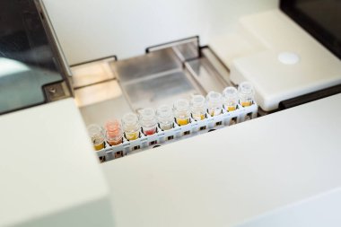 Otomatik biyokimyasal analiz cihazlı laboratuvarlar. Tıbbi laboratuvar ekipmanları. Kapat.