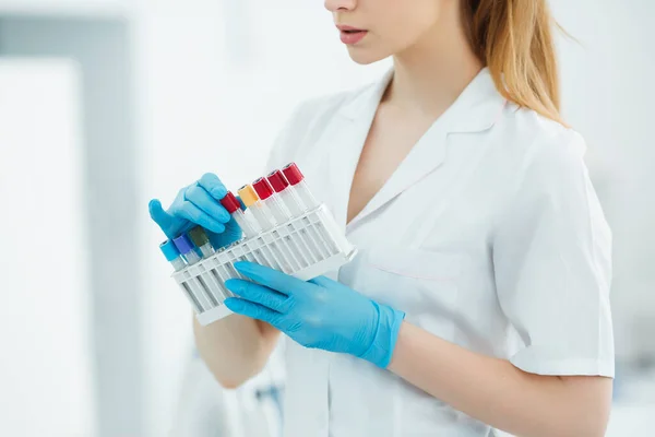 Ręce Technika Laboratoryjnego Trzymającego Stojak Próbkami Krwi Innych Pacjentów — Zdjęcie stockowe