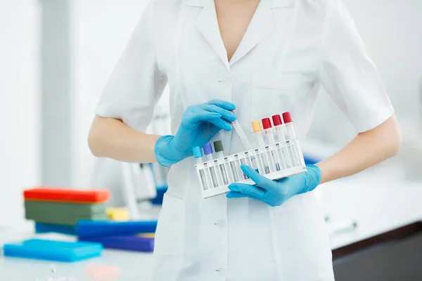 Ręce Technika Laboratoryjnego Trzymającego Stojak Próbkami Krwi Innych Pacjentów — Zdjęcie stockowe