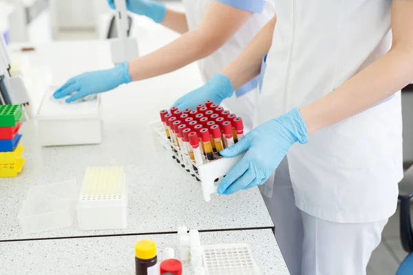 Wykształcenie Medyczne Naukowe Dłonie Asystentów Laboratoryjnych Trzymających Stojak Próbkami Analizy — Zdjęcie stockowe