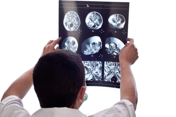 Médico olhando para tomografia computadorizada tomografia imagem tomografia — Fotografia de Stock