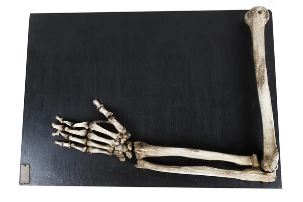 Kemikleri insan eli ile eğitim modeli — Stok fotoğraf