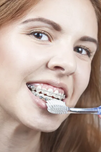 Gigi dan kawat gigi — Stok Foto