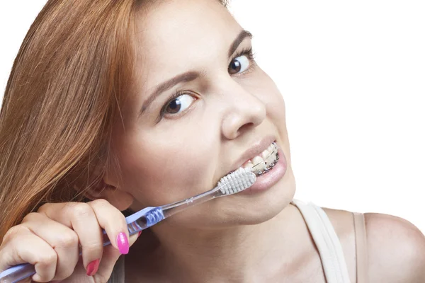 Teeth and braces — Stock Photo, Image