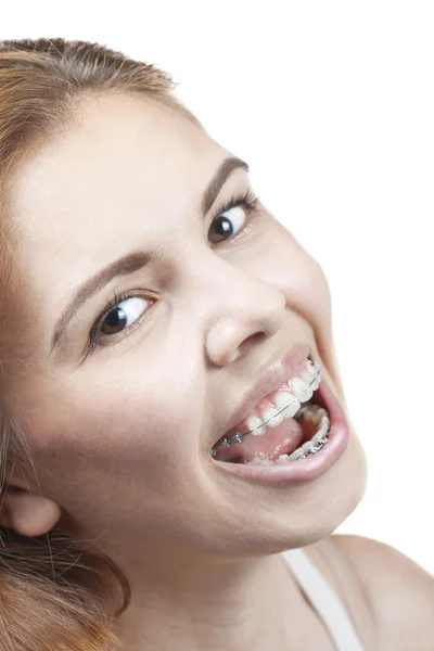 Girl with braces — Stock Photo, Image